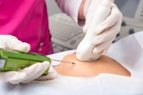 Biopsias guiadas por imagen: una herramienta clave para diagnósticos precisos